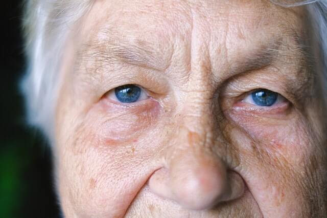 Dry Eyes As We Age Optometrist