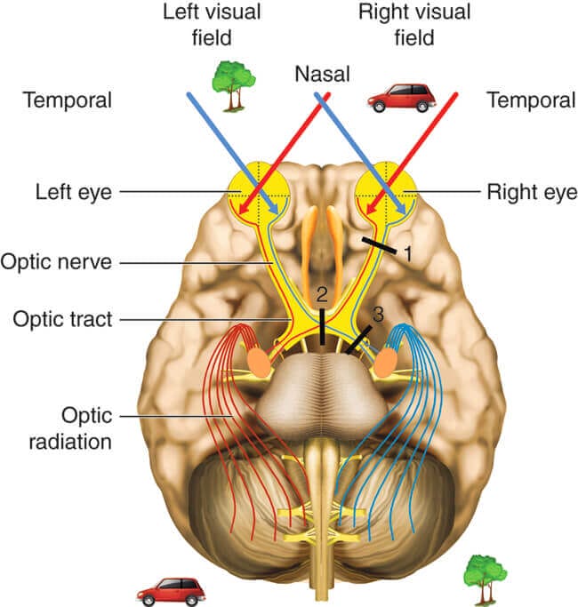 Vision Therapy Awareness Optometrist