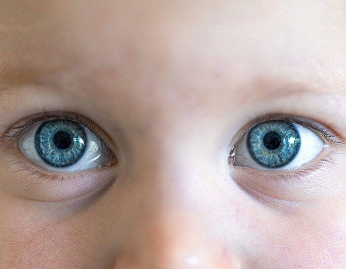 Advantages of Contact Lenses for Children
