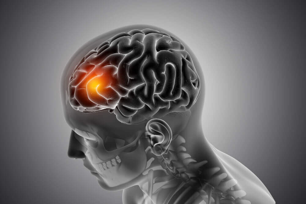 What are symptoms of vision related issues resulting from acquired brain injury?